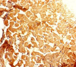 GALM Antibody