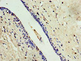 ALG1 Antibody
