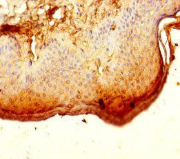 ALG12 Antibody