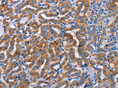 ALG12 Antibody