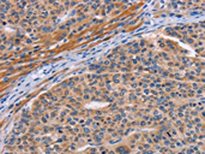 ALG12 Antibody