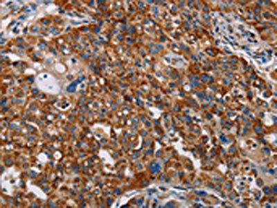 ALG2 Antibody