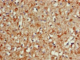 ALK Antibody