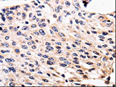 ALK Antibody