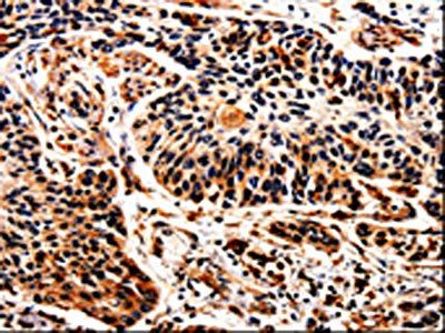 ALOX5 Antibody