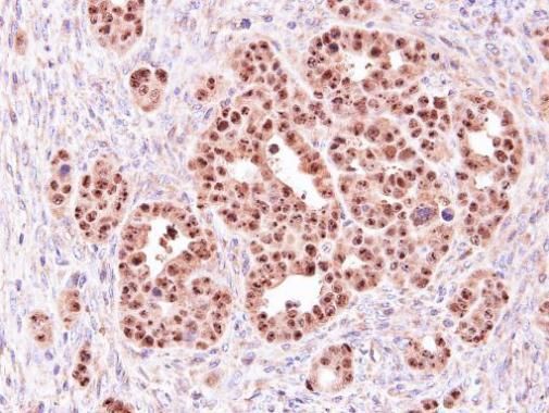 ALOXE3 Rabbit Polyclonal Antibody