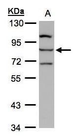 ALOXE3 Rabbit Polyclonal Antibody