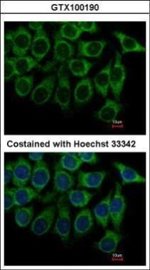 adrenoceptor alpha 1A Antibody