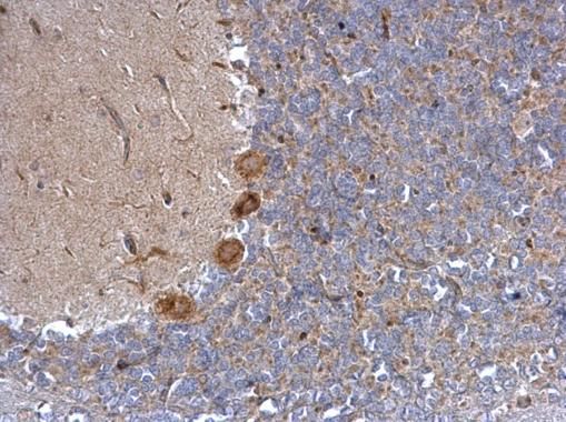 adrenoceptor alpha 1A Antibody