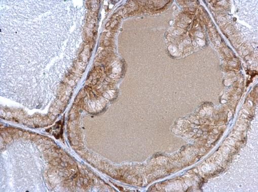 adrenoceptor alpha 1A Antibody