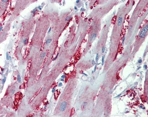 adrenoceptor alpha 1A Antibody