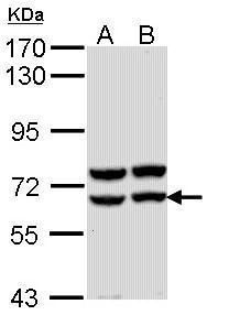 alpha amylase 2A (pancreatic) antibody [N2C3]