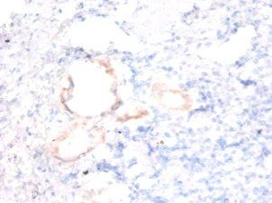 ENSA Antibody