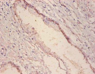 GLA Antibody