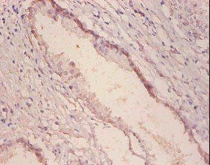 GLA Antibody (Biotin)
