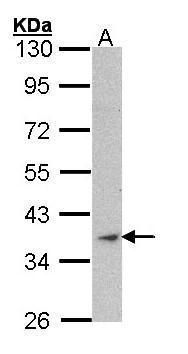 adhesion G protein-coupled receptor E1 Antibody