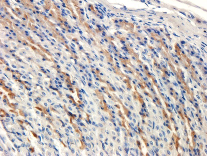 alpha 1 Antitrypsin antibody