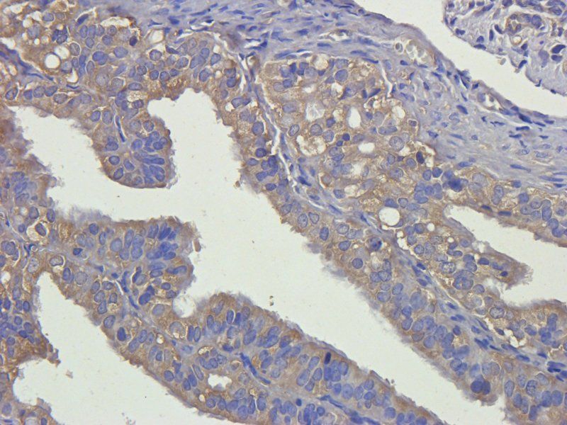 alpha 1 Antitrypsin antibody