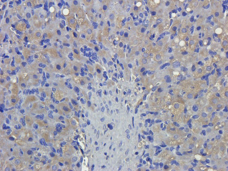 alpha 1 Antitrypsin antibody