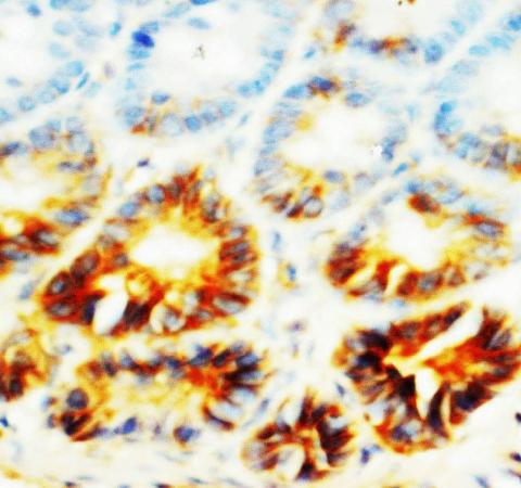 Alkaline Phosphatase/ALPL Rabbit Polyclonal Antibody