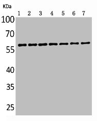 ALPP/ALPPL2 Antibody