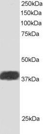 ALS2CR1/NIF3L1 Antibody
