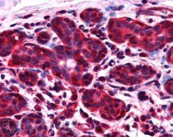 ALS2CR1/NIF3L1 Antibody