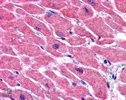 ALS2CR2/ILPIP Antibody