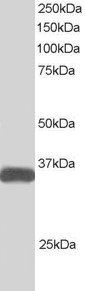 ALS2CR2/ILPIP Antibody