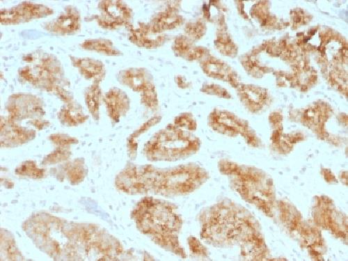 AMACR Antibody