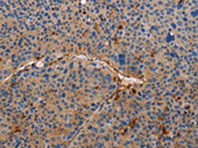 AMBRA1 Antibody