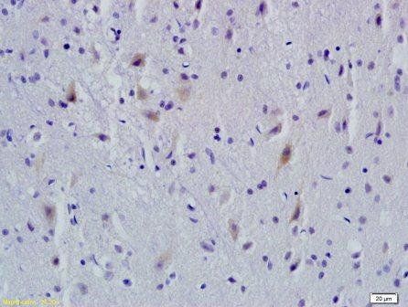 AMBRA1 Rabbit Polyclonal Antibody