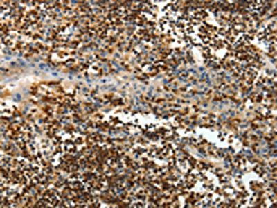 AMD1 Antibody