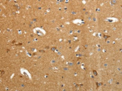 AMD1 Antibody