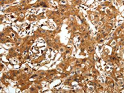 AMD1 Antibody