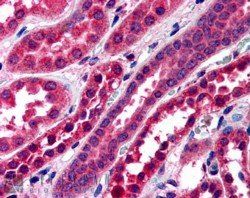Amisyn/STXBP6 Antibody