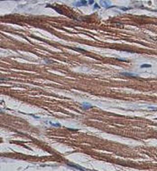 AMPD1 Rabbit Polyclonal Antibody