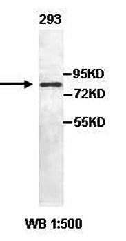 AMPD1 Rabbit Polyclonal Antibody