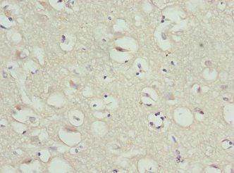 SAA1 Antibody