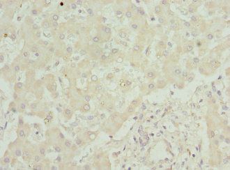 SAA1 Antibody