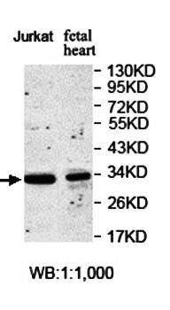ANAPC10 Rabbit Polyclonal Antibody