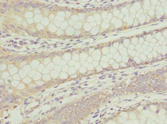 ANAPC2 Antibody