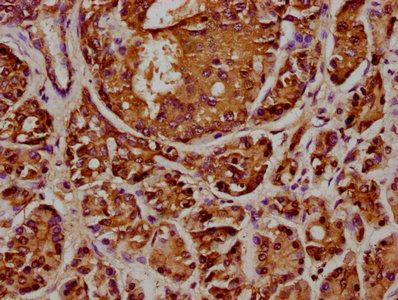 ANAPC2 Antibody
