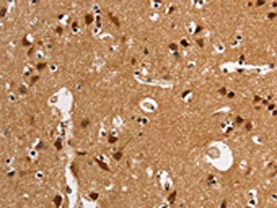 ANAPC4 Antibody