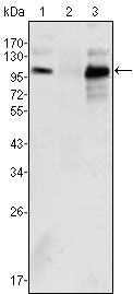 Androgen receptor Antibody