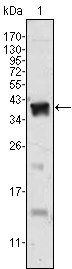 Androgen receptor Antibody