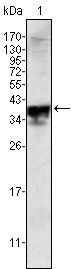 Androgen receptor Antibody