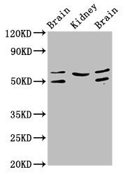 ANGPT2 Antibody