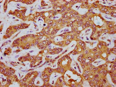 AGT Antibody
