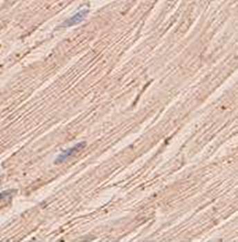 ANGPTL1 Rabbit Polyclonal Antibody